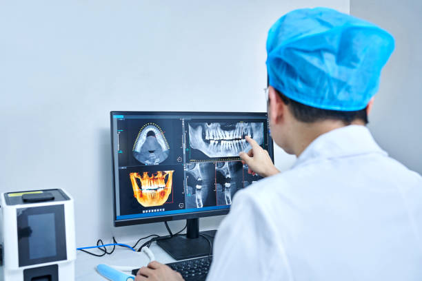 Best Knocked-Out Tooth (Avulsed Tooth) Treatment in Cole Camp, MO